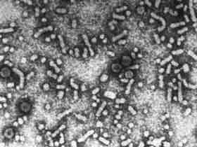 Гепатит В. Фото с сайта www.konchalovsky.ru Гепатит В. Фото с сайта www.konchalovsky.ru