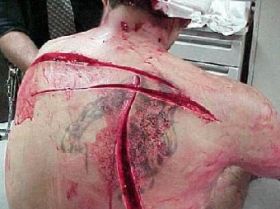 Раны заключенных, фото с сайта upmonitor.ru Раны заключенных, фото с сайта upmonitor.ru