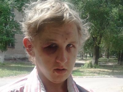 Избиение. Фото Павла Валерина, Каспаров.Ru Избиение. Фото Павла Валерина, Каспаров.Ru