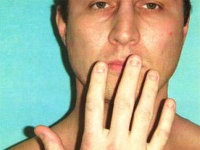 Вырванные ногти. Фото: news.rufox.ru Вырванные ногти. Фото: news.rufox.ru